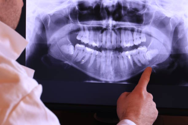 Best Emergency Dentist for Special Needs Patients in Norris City, IL